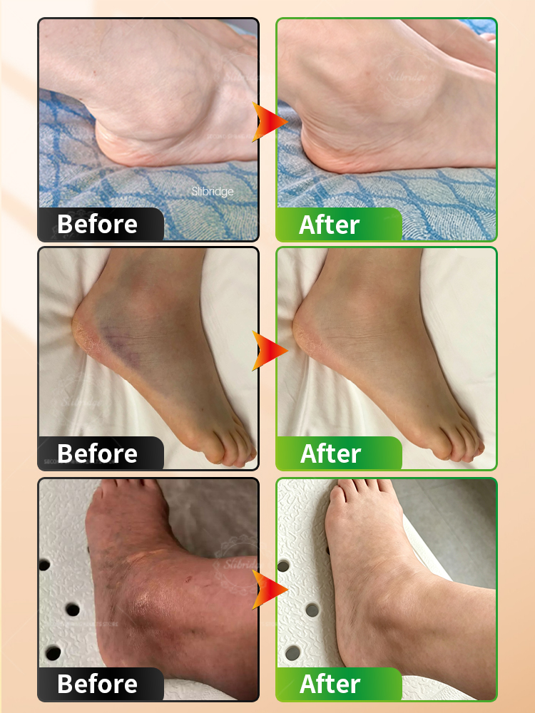 Portable Heated Ankle Massager - Ankle Mobility Band ulasan dan harga